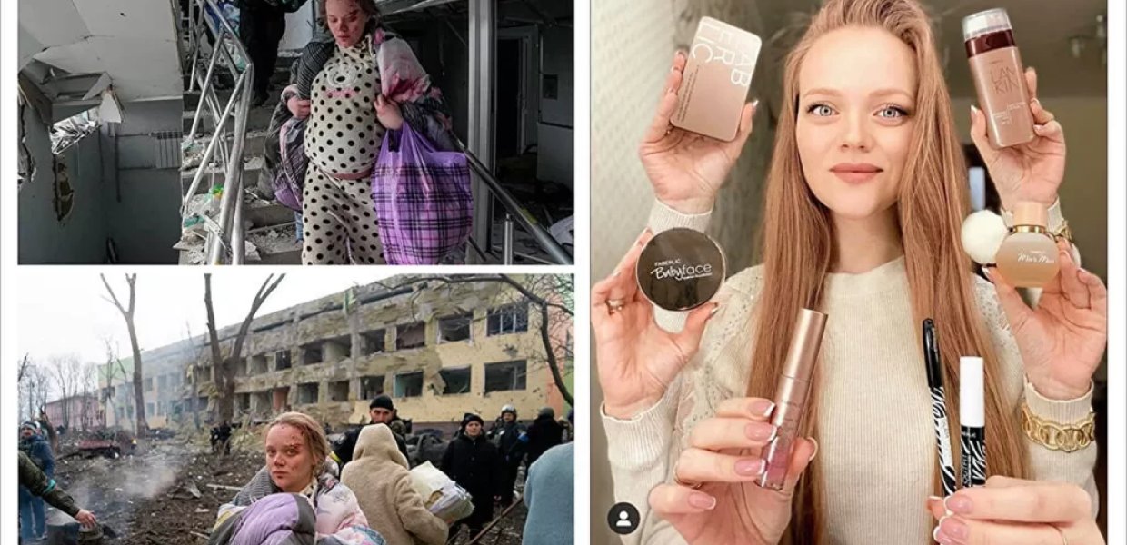Ζωντανή η έγκυος της Μαριούπολης και ζει στην Ρωσία: «Μας χτύπησαν οβίδες – Δεν ήταν αεροπορικό πλήγμα»