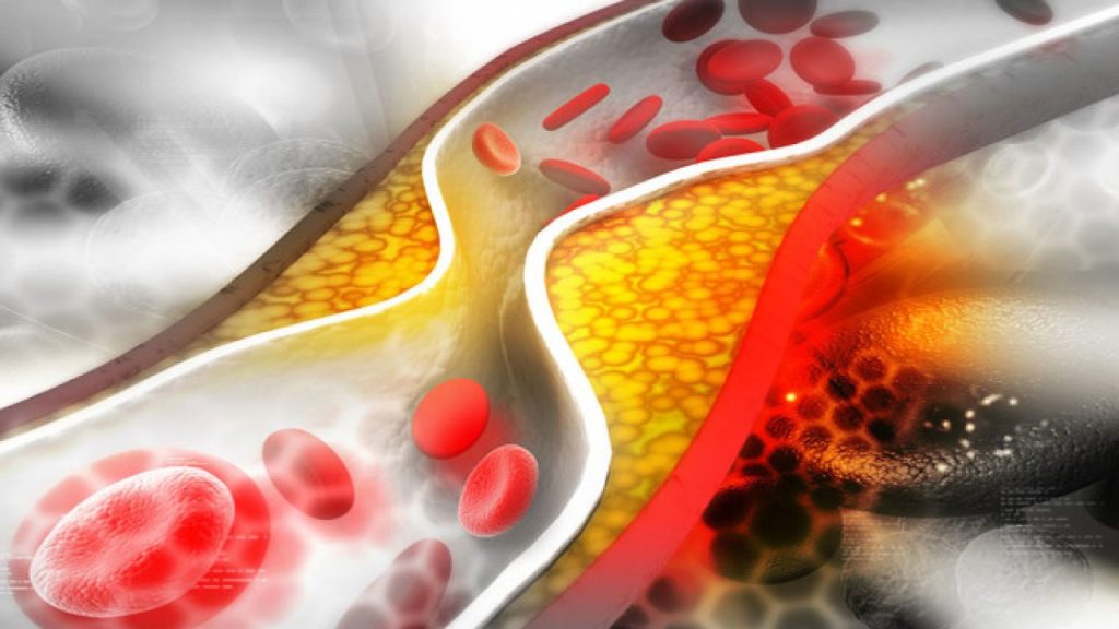 Έτσι θα αυξήσετε την καλή χοληστερίνη στο αίμα σας –  Τα όρια για άνδρες & γυναίκες