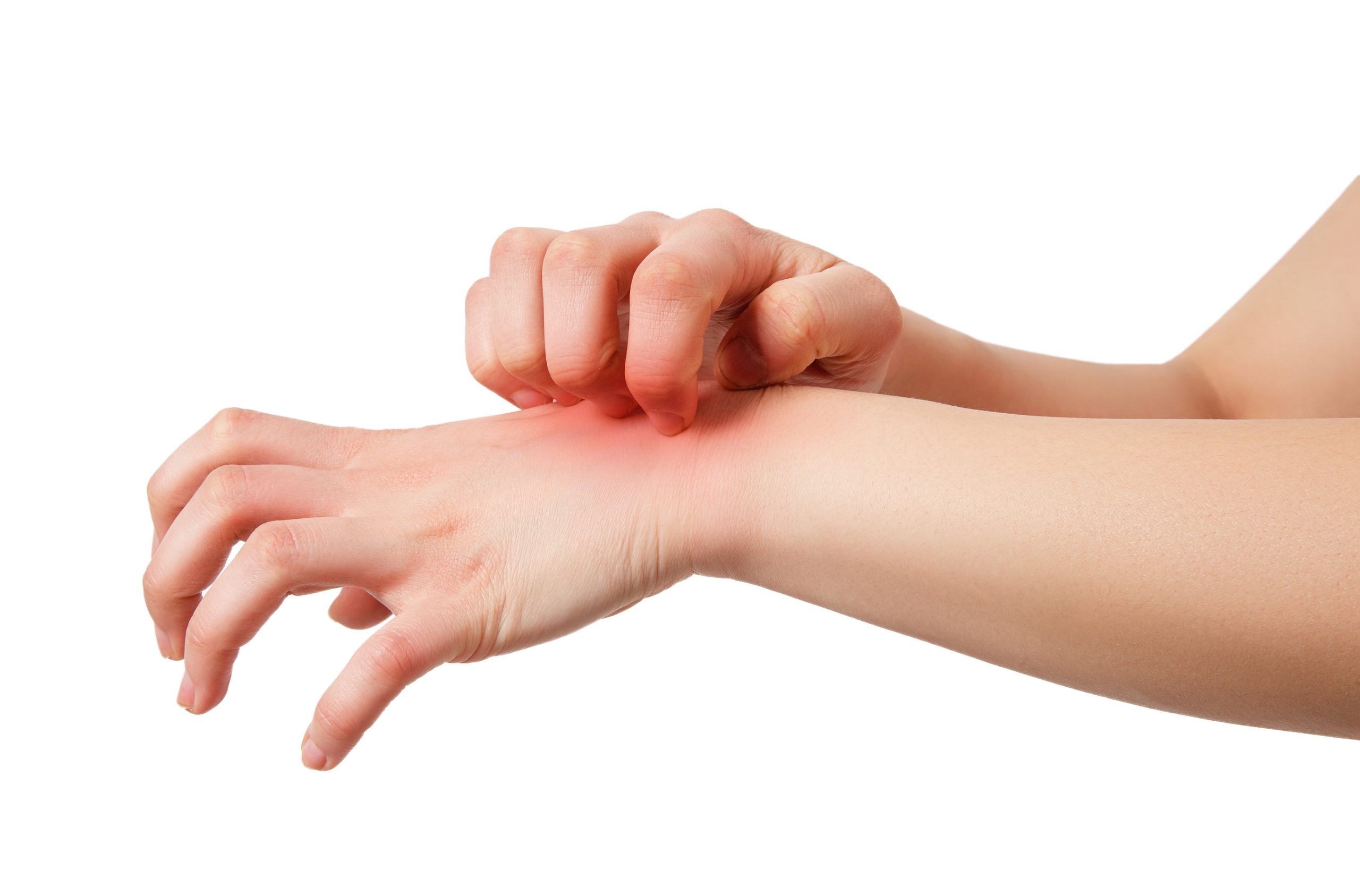 Αυτές είναι οι πιθανές αιτίες της φαγούρας χωρίς εξανθήματα