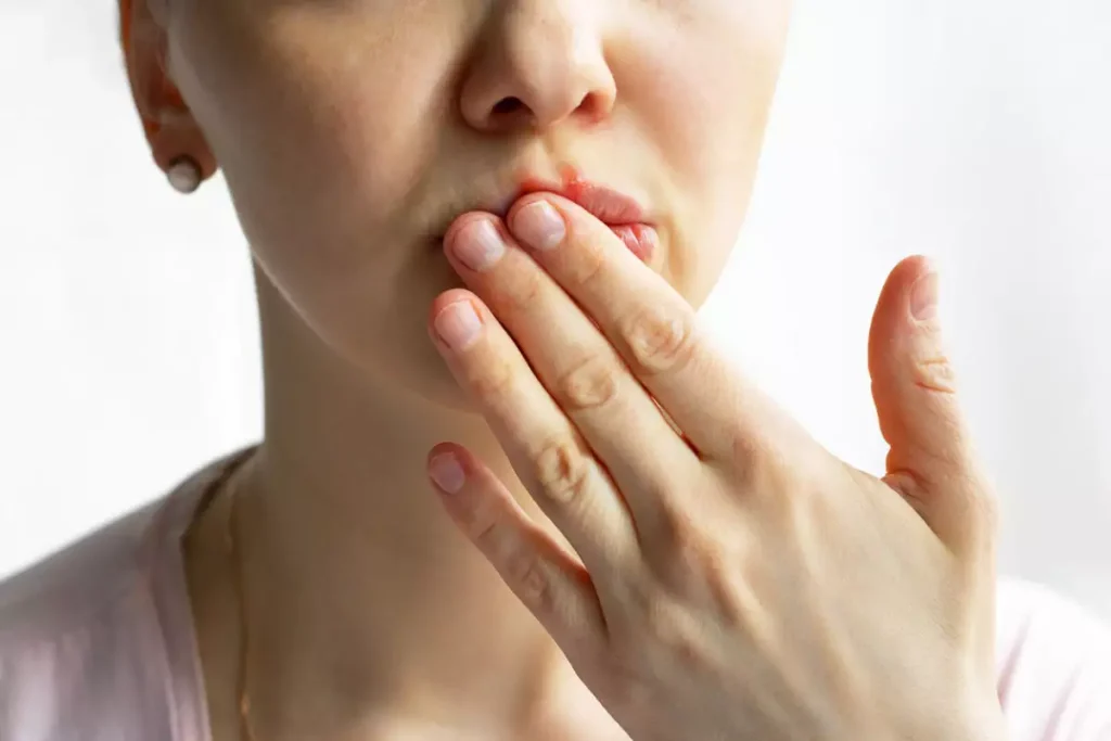 Καρκίνος του στόματος: Ποια είναι τα ύποπτα συμπτώματα – Η σχέση με τον ιό HPV