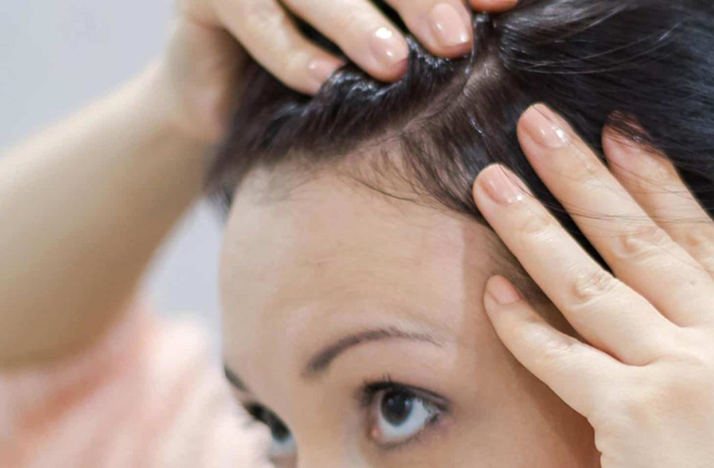 Τι είναι η ατοπική δερματίτιδα στο τριχωτό της κεφαλής – Ποια είναι τα συμπτώματα και πως να την αποτρέψετε