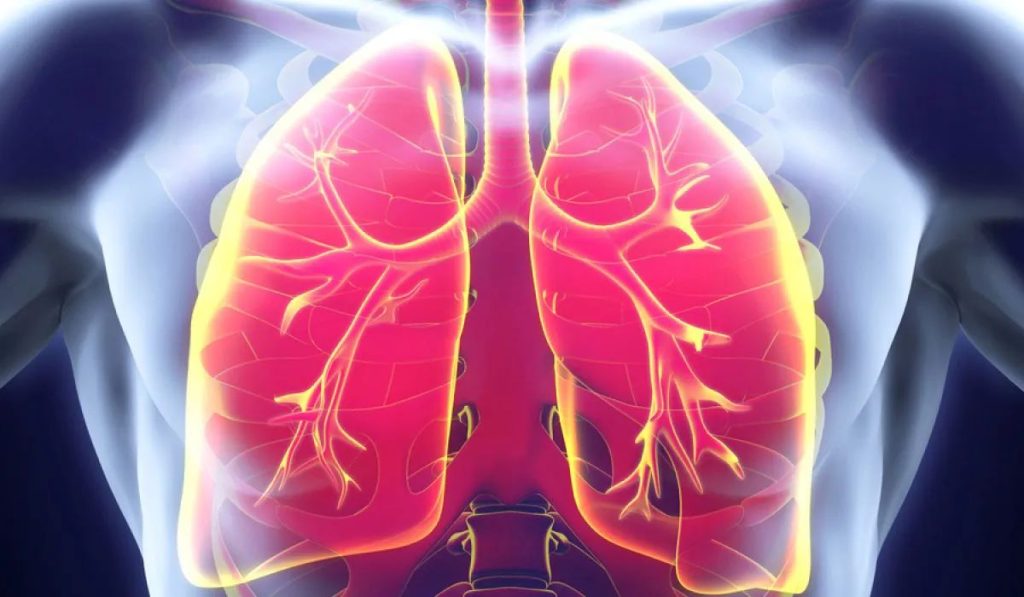 Ιδιοπαθής πνευμονική ίνωση: Πιθανά αίτια, συμπτώματα & τρόποι αντιμετώπισης