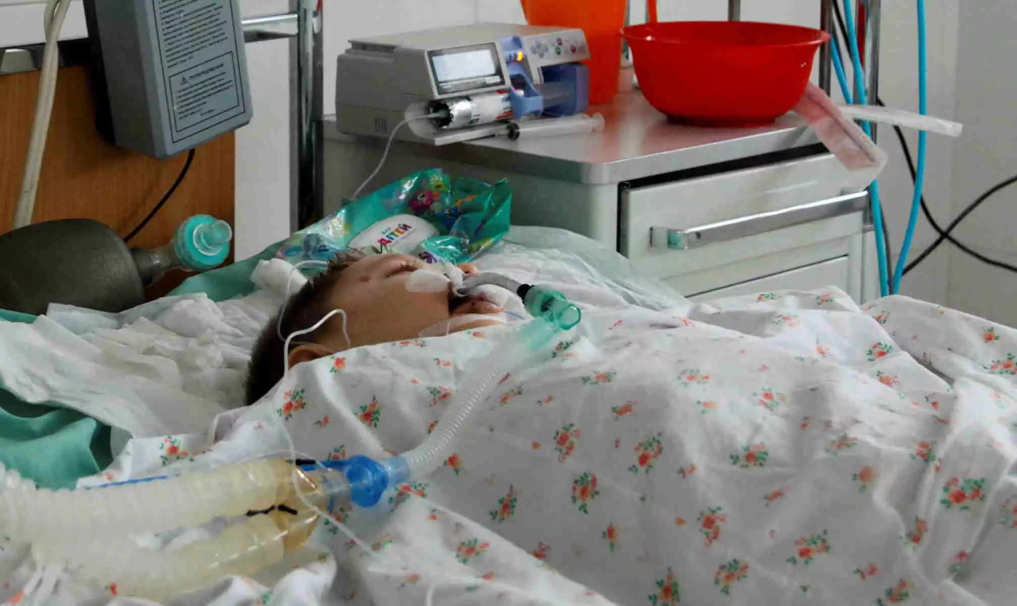 Ινδονησία: Τρία παιδιά πέθαναν από οξεία ηπατίτιδα – 15 συνολικά περιστατικά