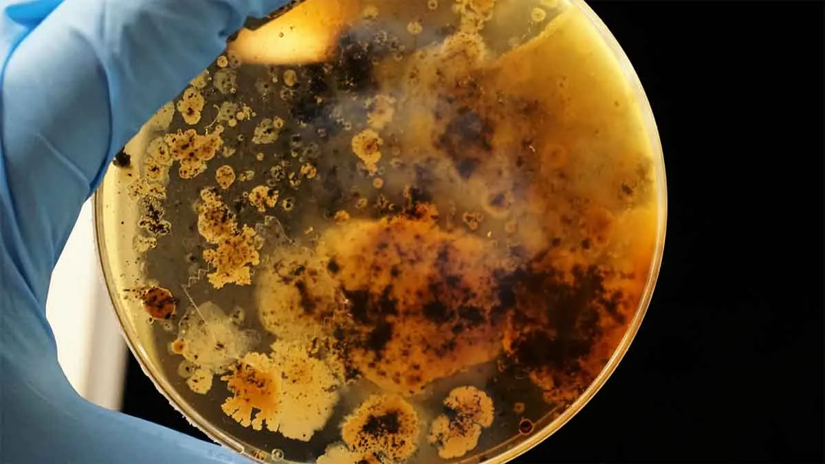 Μύκητας Candida auris: Ποια είναι η προέλευσή του και γιατί ανησυχεί τους ειδικούς