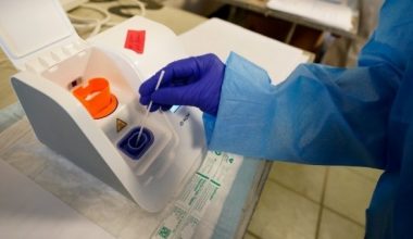 Κορωνοϊός: Επιστήμονες ανέπτυξαν νέο τεστ που ανιχνεύει τα αντισώματα στα ούρα και όχι στο αίμα