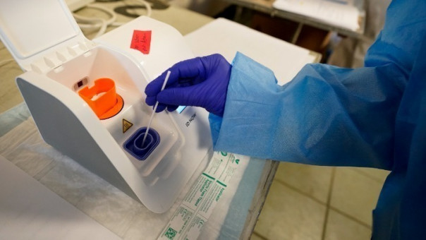 Κορωνοϊός: Επιστήμονες ανέπτυξαν νέο τεστ που ανιχνεύει τα αντισώματα στα ούρα και όχι στο αίμα