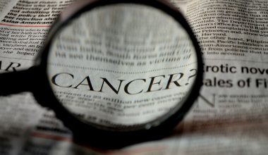 Νέα μελέτη: Ο ανδρικός καρκίνος του μαστού σχετίζεται με την υπογονιμότητα