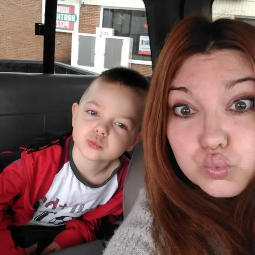 ΗΠΑ: Πεντάχρονος έχασε το χαμόγελό του μετά από επίθεση του σκύλου του (φωτο)