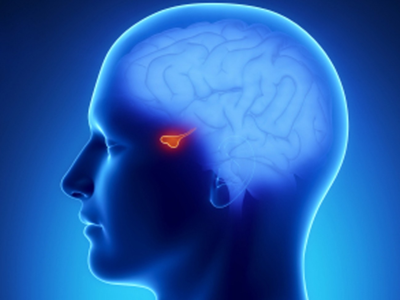 Αδένωμα υπόφυσης: Τα «αθώα» συμπτώματα που δεν πρέπει να αγνοείτε