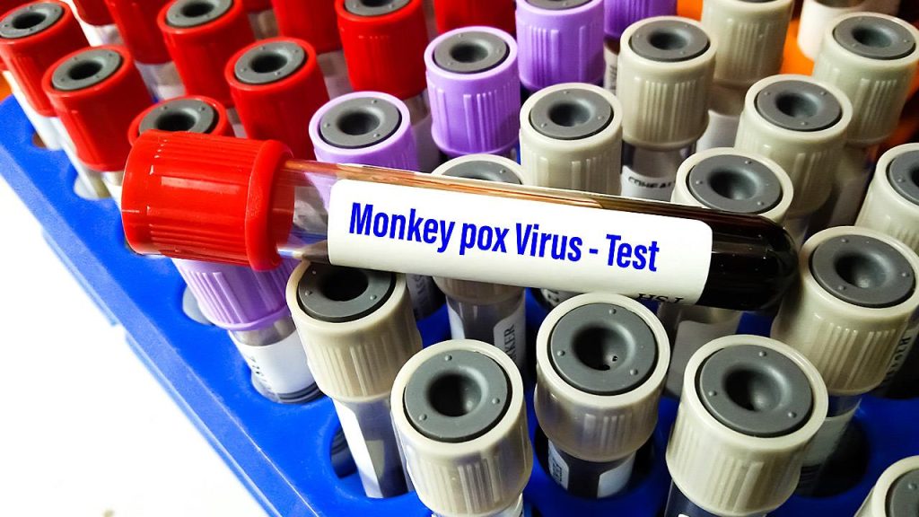 Δεν θα απαλλαγούμε ποτέ – Τα CDC συνιστούν τη χρήση μάσκας στα ταξίδια λόγω της ευλογιάς των πιθήκων