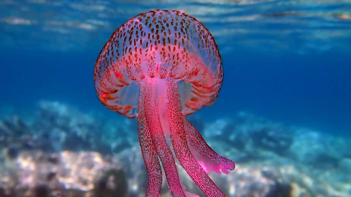 Γυναίκα που τσιμπήθηκε από μωβ μέδουσα: «Με έτσουζε πάρα πολύ λες και μου έριξαν βιτριόλι – Έβραζε το δέρμα μου»