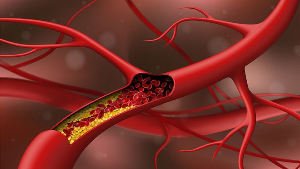 Η συνήθεια σε αυτά που πίνετε που μειώνει τη χοληστερόλη μετά τα 50