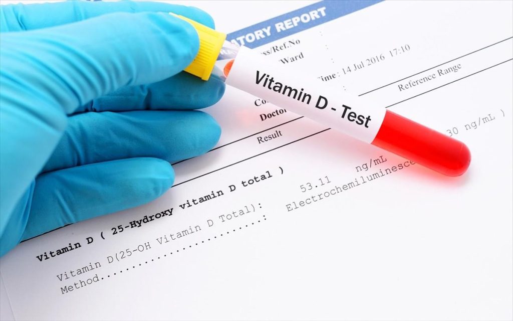 Έλλειψη βιταμίνης D: 15 παράξενα συμπτώματα που δεν πρέπει να αγνοήσετε