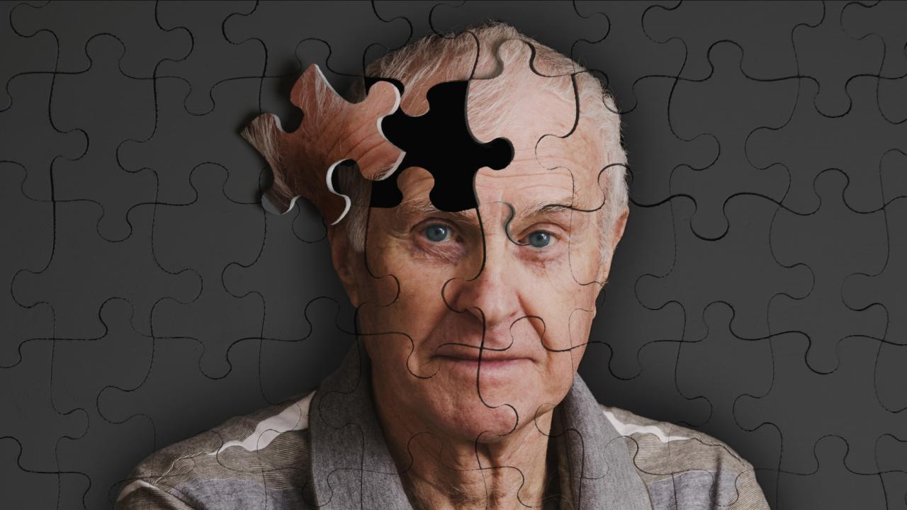 Μελέτη: Πιθανή πρώιμη ένδειξη αλτσχάιμερ αν ένας ηλικιωμένος είναι πρόθυμος να δίνει γενναιόδωρα τα χρήματά του