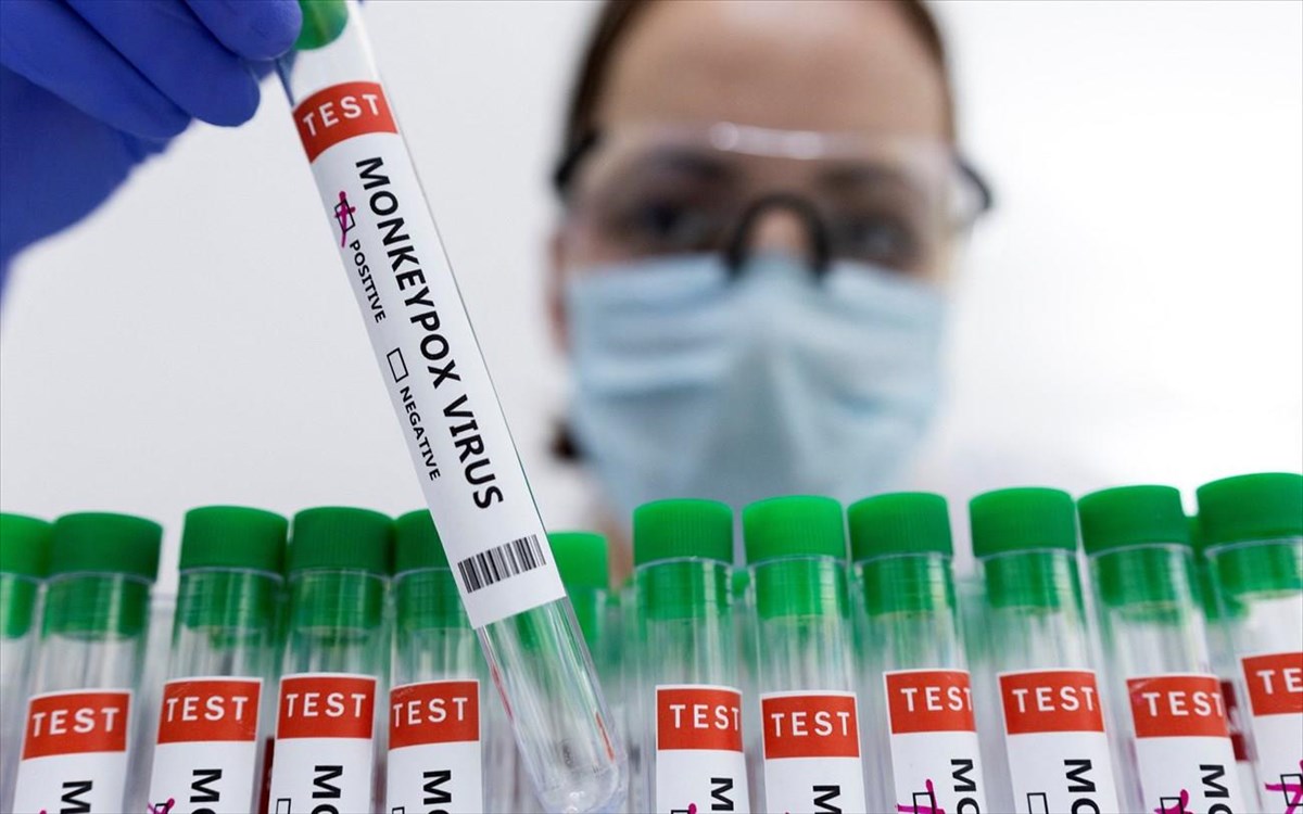 Ευλογιά των πιθήκων: Η κυβέρνηση Μπάιντεν θα διαθέσει 296.000 δόσεις εμβολίων σε πολιτείες των ΗΠΑ