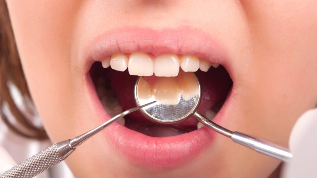Tο «θαυματουργό» ρόφημα που εξαφανίζει την οδοντική πλάκα!