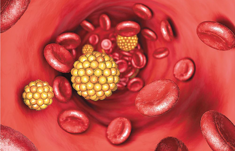  Το πού νιώθετε πόνο στο σώμα σας αποτελεί σημάδι υψηλής χοληστερίνης