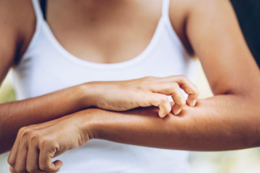 Αλλεργίες στον ήλιο: Πώς να καταλάβετε ότι πάσχετε και πώς να τις αντιμετωπίσετε