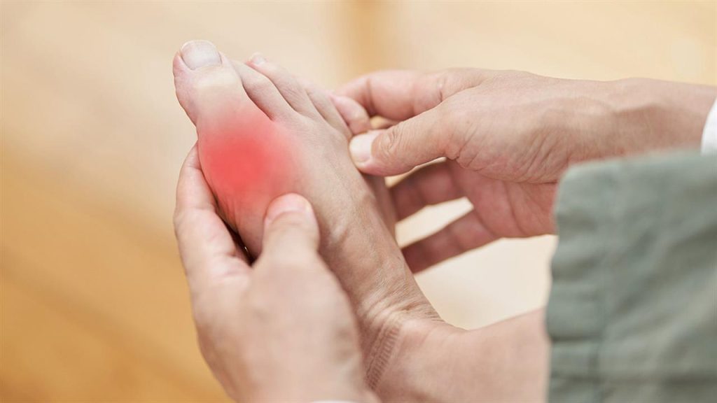 Ουρική αρθρίτιδα: Τα συμπτώματα, οι επιπλοκές & η κατάλληλη διατροφή