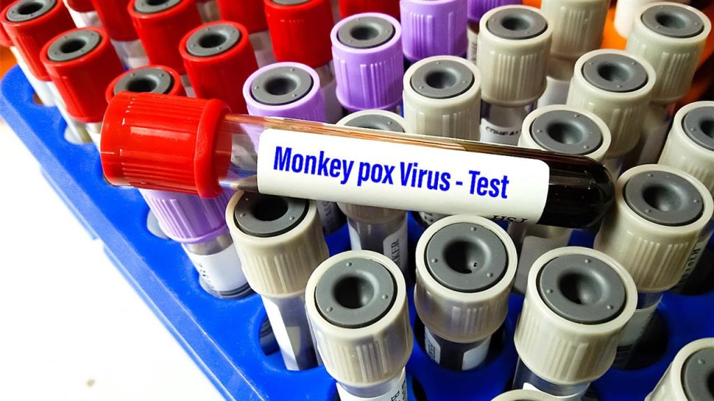 Στο Πανεπιστημιακό Νοσοκομείο Λάρισας νοσηλεύεται άνδρας με ευλογιά των πιθήκων