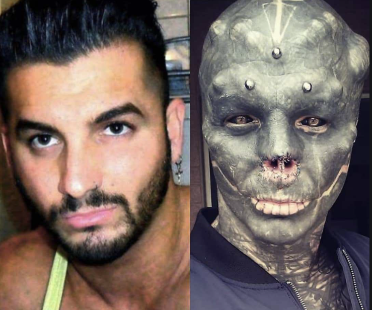 «Black Alien»: Δεν φτάνει που αφαίρεσε δύο δάχτυλά και τα δύο αυτιά – Θα ακρωτηριάσει και το πόδι του (βίντεο)