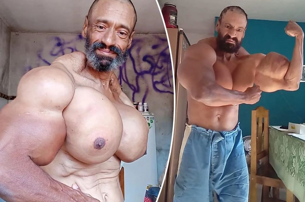 Πέθανε ο 55χρονος Βραζιλιάνος «Hulk»: Έκανε ενέσεις λαδιού για να… «φουσκώσει» τους μύες του (βίντεο)