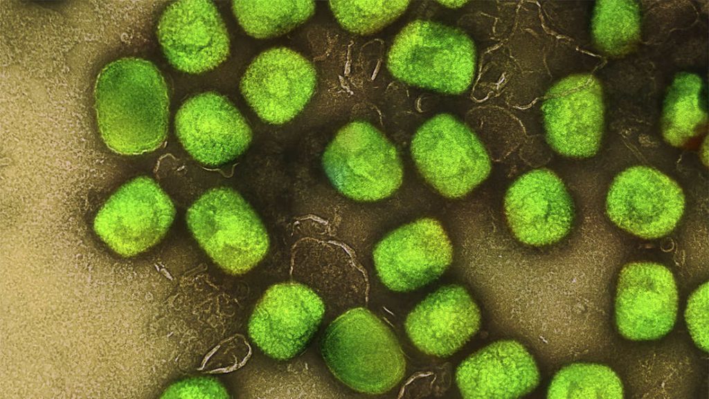 Ρωσικό ΥΠ.ΑΜ.: «Δεν μπορεί να αποκλειστεί ο COVID να είναι δημιούργημα των ΗΠΑ – Έκαναν πειράματα σε ουκρανικά εργαστήρια»