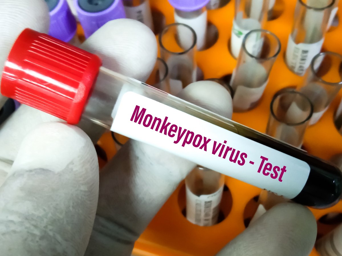 ΕΟΔΥ: Στα 39 ανέρχονται τα κρούσματα ευλογιάς των πιθήκων στην Ελλάδα – Όλα αφορούν άνδρες