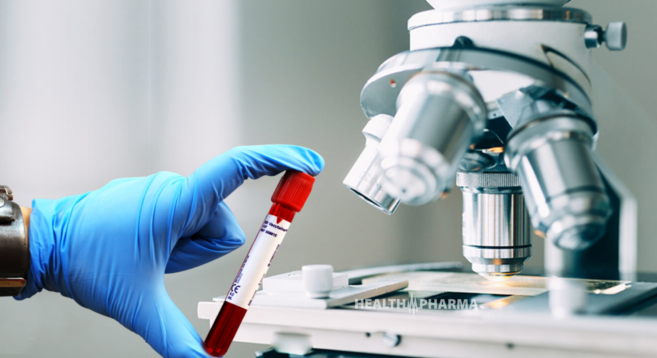 Σπουδαία έρευνα: Τεστ αίματος ανιχνεύει τον καρκίνο πριν εκδηλωθούν τα κύρια συμπτώματα