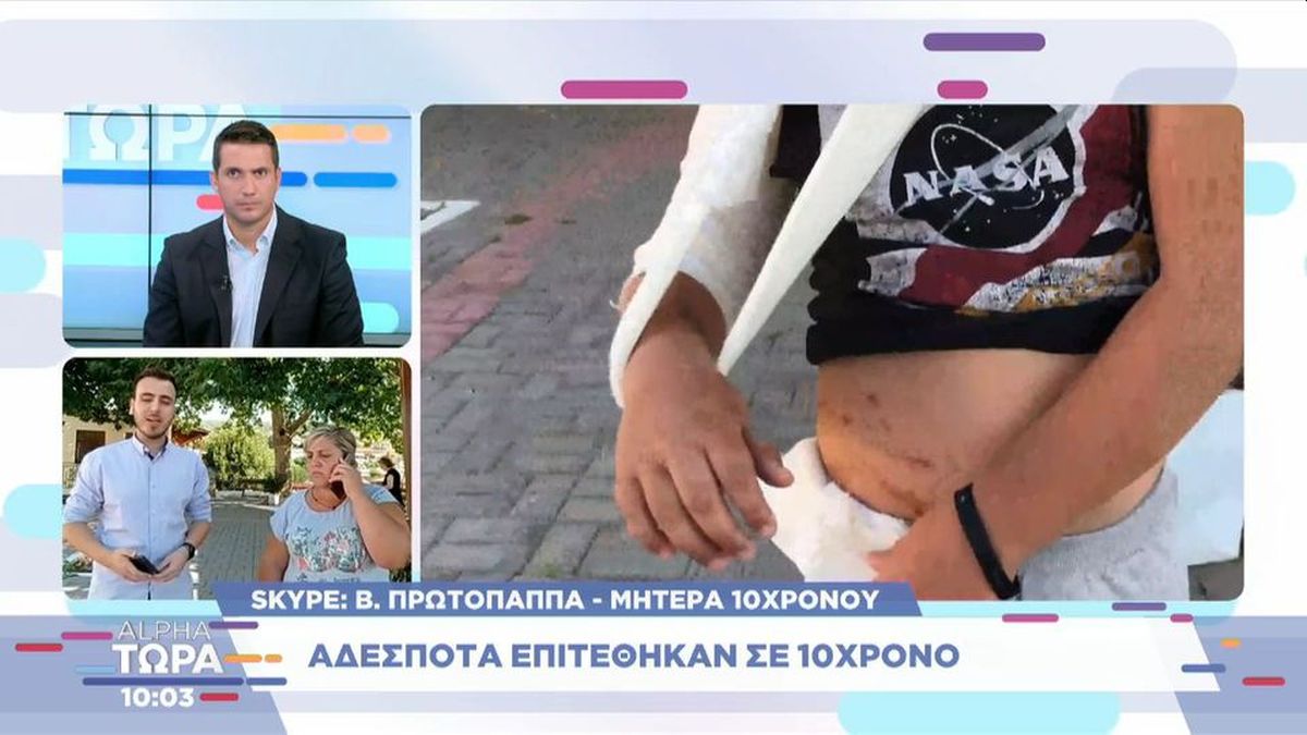 Οργισμένη η μητέρα του 10χρονου που δέχθηκε επίθεση από αδέσποτα στη Φθιώτιδα: «Το παιδί ήταν μέσα στα αίματα»