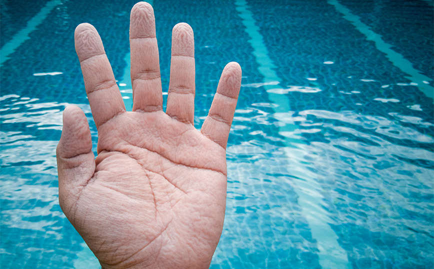 Γιατί ζαρώνουν τα δάχτυλά σας μέσα στο νερό; – Δεν είναι επειδή «μούλιασαν»