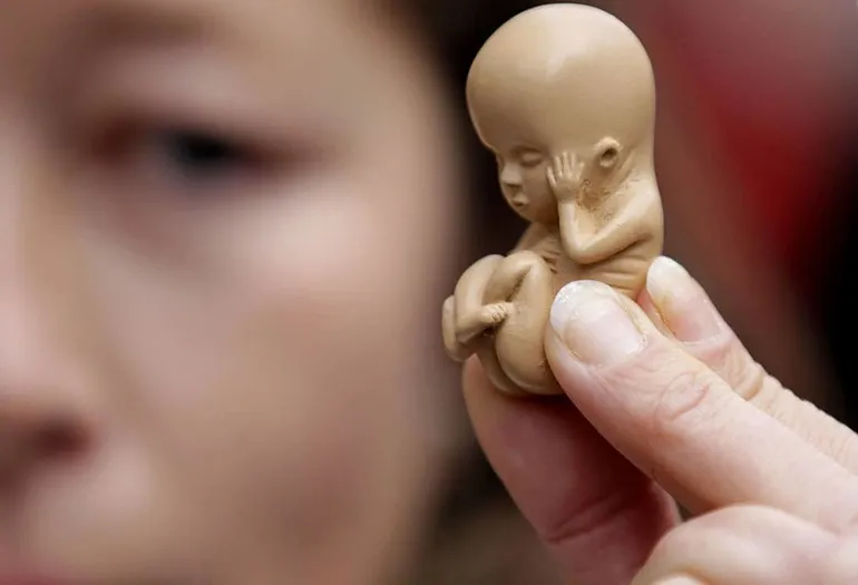 ΗΠΑ – Λουιζιάνα: Αρνούνται άμβλωση σε γυναίκα που κυοφορεί έμβρυο με θανατηφόρο πάθηση -Πάσχει από ακρανία