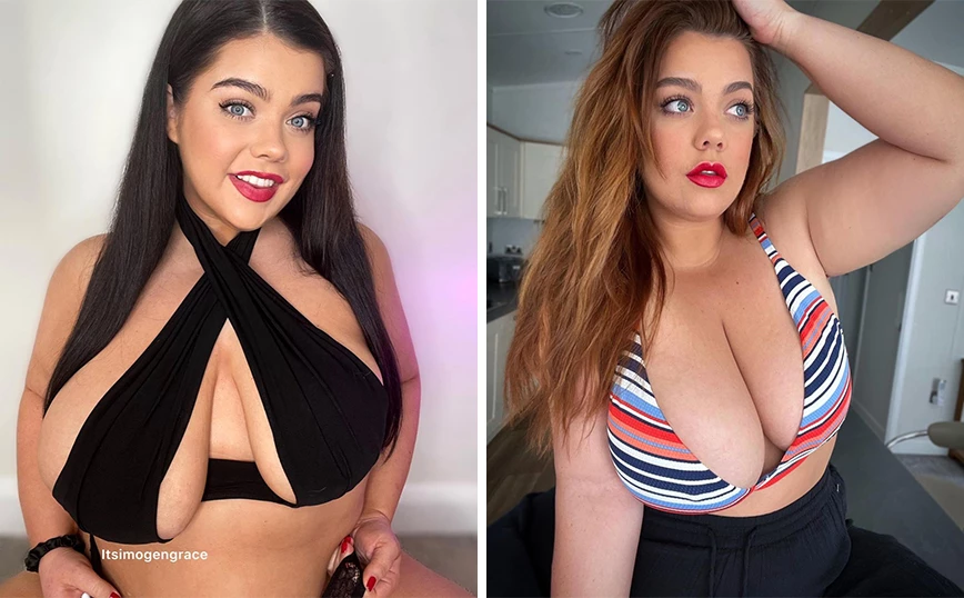  26χρονη από την Βρετανία: Έχει το ένα στήθος διπλάσιο από το άλλο – Βρήκε «λύση» στο TikTok και έγινε viral