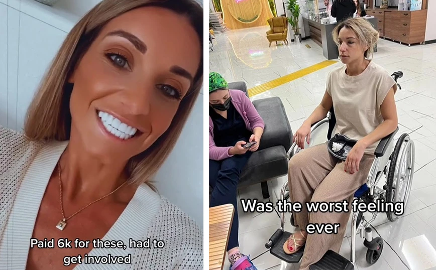 «Δόντια Τουρκίας»: Πλήρωσε 6 χιλιάδες λίρες για χειρουργείο 8 ωρών – Κατέληξε με κατεστραμμένα δόντια