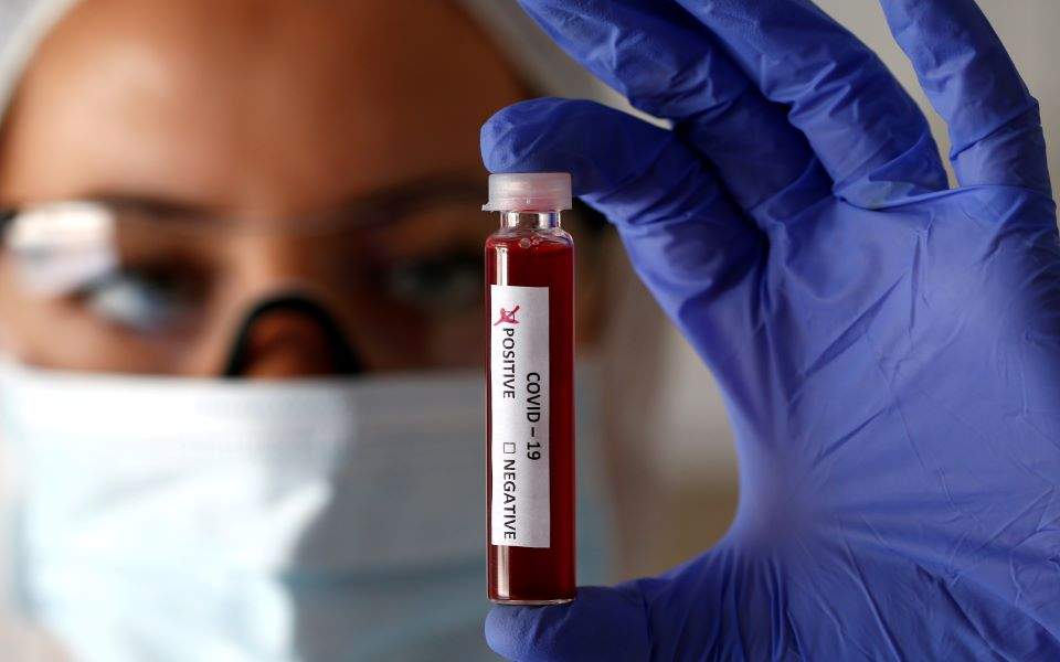 Δεν έχουν όλες οι ομάδες αίματος τον ίδιο κίνδυνο για πρώιμο εγκεφαλικό πριν τα 60 σύμφωνα με έρευνα