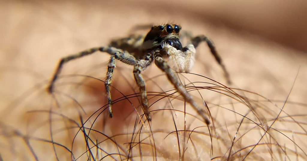 Βρετανία: 43χρονη γέμισε μελανιές μετά από τσίμπημα αράχνης (φωτο)