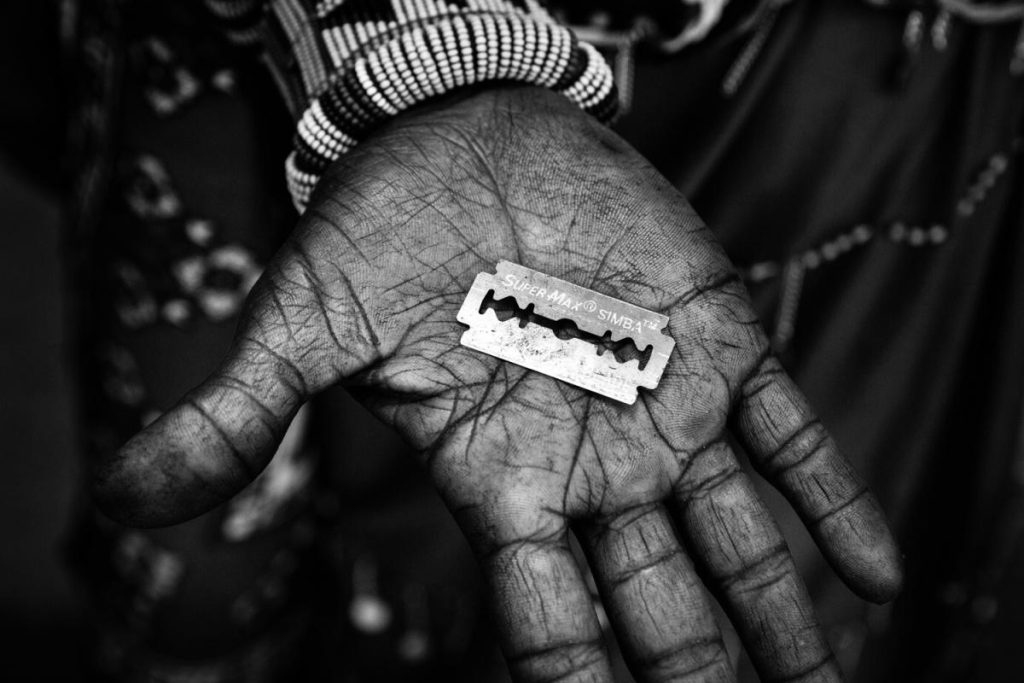 Κλειτοριδεκτομή: Τουλάχιστον 100 εκατ. γυναίκες την έχουν υποστεί σε 30 χώρες