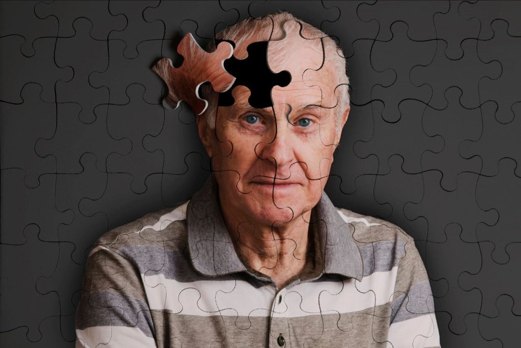 Οι ηλικιωμένοι που νόσησαν με κορωνοϊό έχουν αυξημένο κίνδυνο για εμφάνιση Αλτσχάιμερ μέσα στον επόμενο χρόνο