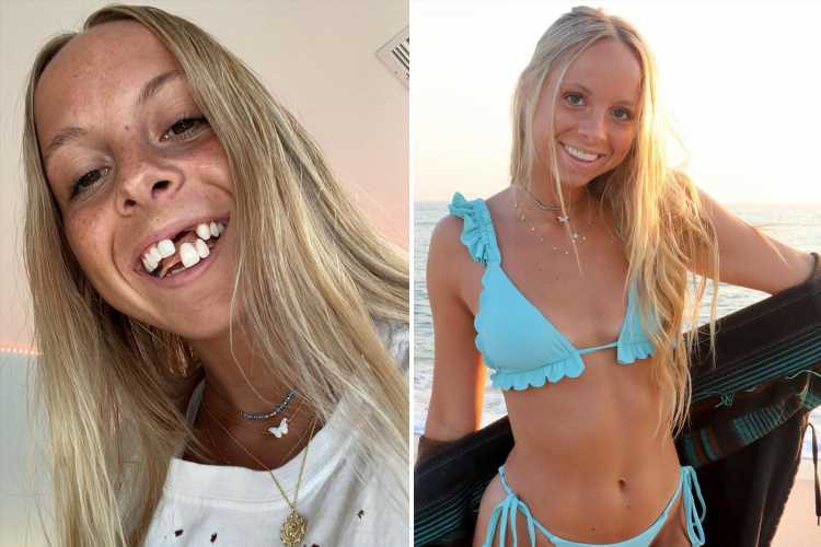 Μη σου τύχει: 25χρονη που δεν έχει μπροστινά δόντια σοκάρει τους άντρες στα πρώτα ραντεβού!