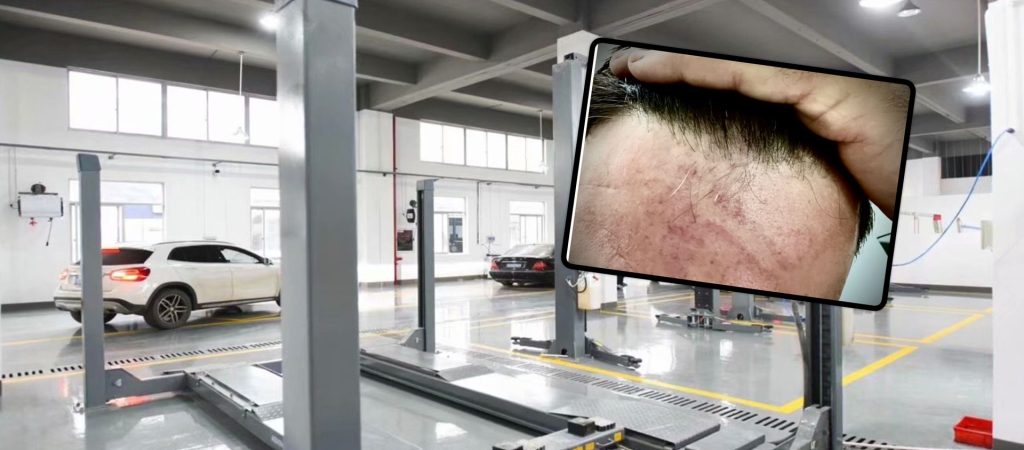 Λασίθι: Ξυλοκόπησαν αστυνομικό μέσα σε συνεργείο (φωτό)