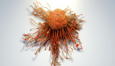 Σπουδαία ανακάλυψη για τον καρκίνο: Επιστήμονες εντόπισαν την πρωτεΐνη που ενεργοποιεί τις μεταστάσεις