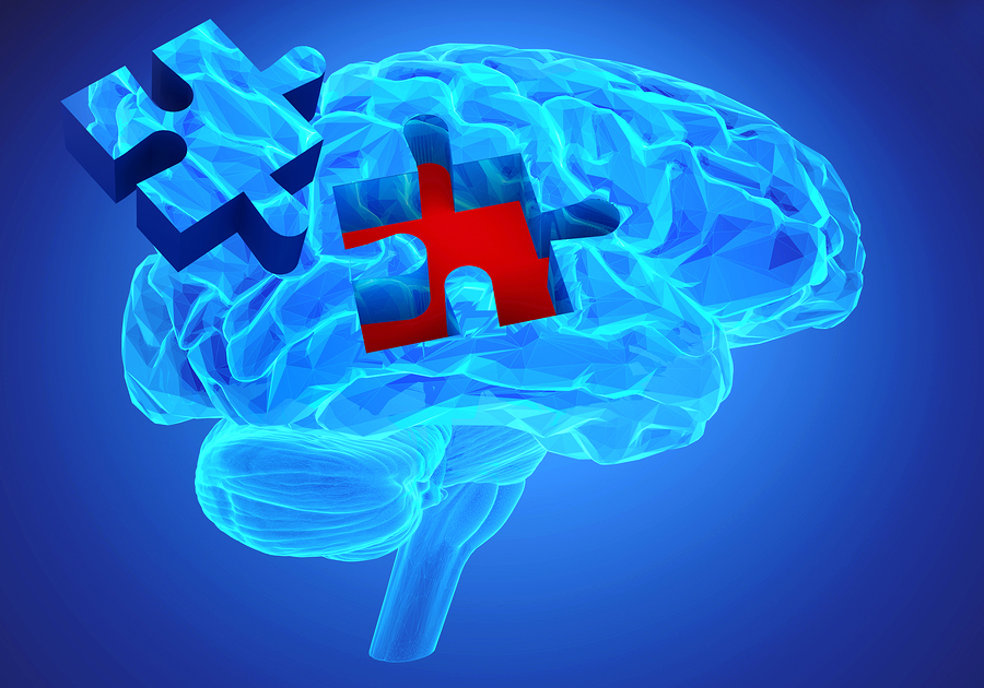 Αλτσχάιμερ: Οι πολυβιταμίνες σε καθημερινή βάση μπορούν να βοηθήσουν το μυαλό και τη μνήμη των ηλικιωμένων