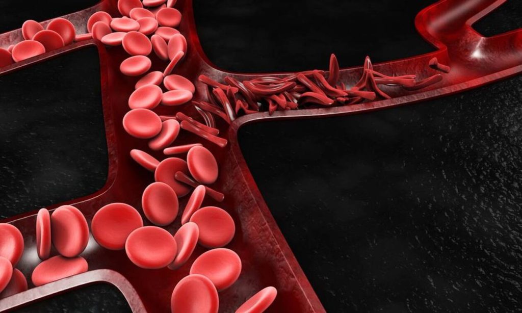Δείτε τι πρέπει να κάνετε για να βελτιώσετε την κυκλοφορία του αίματος στις αρτηρίες σας