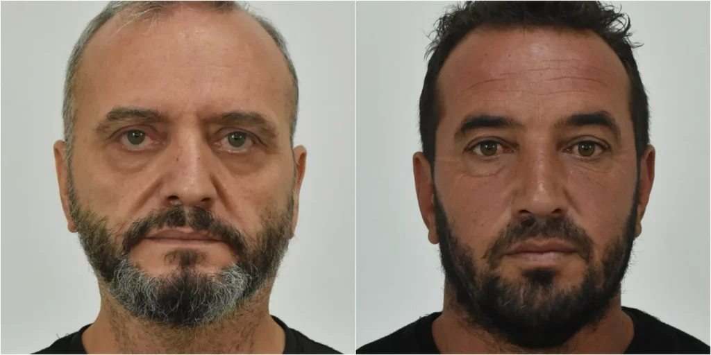 Κολωνός: Αποτροπιασμό προκαλούν οι απολογίες των παιδοβιαστών – «Γνώριζα την ηλικία της μικρής» είπε ο Ηλίας Μίχος