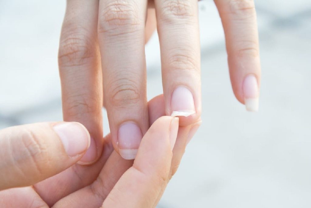 Το σημάδι στα νύχια που «δείχνει» ότι υπάρχει πρόβλημα στον θυρεοειδή σας