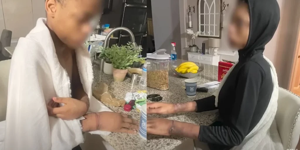 Φρίκη στο Τέξας: Μητέρα έδινε στα παιδιά της να πιουν χλωρίνη & τα έκαιγε (φωτό & βίντεο)