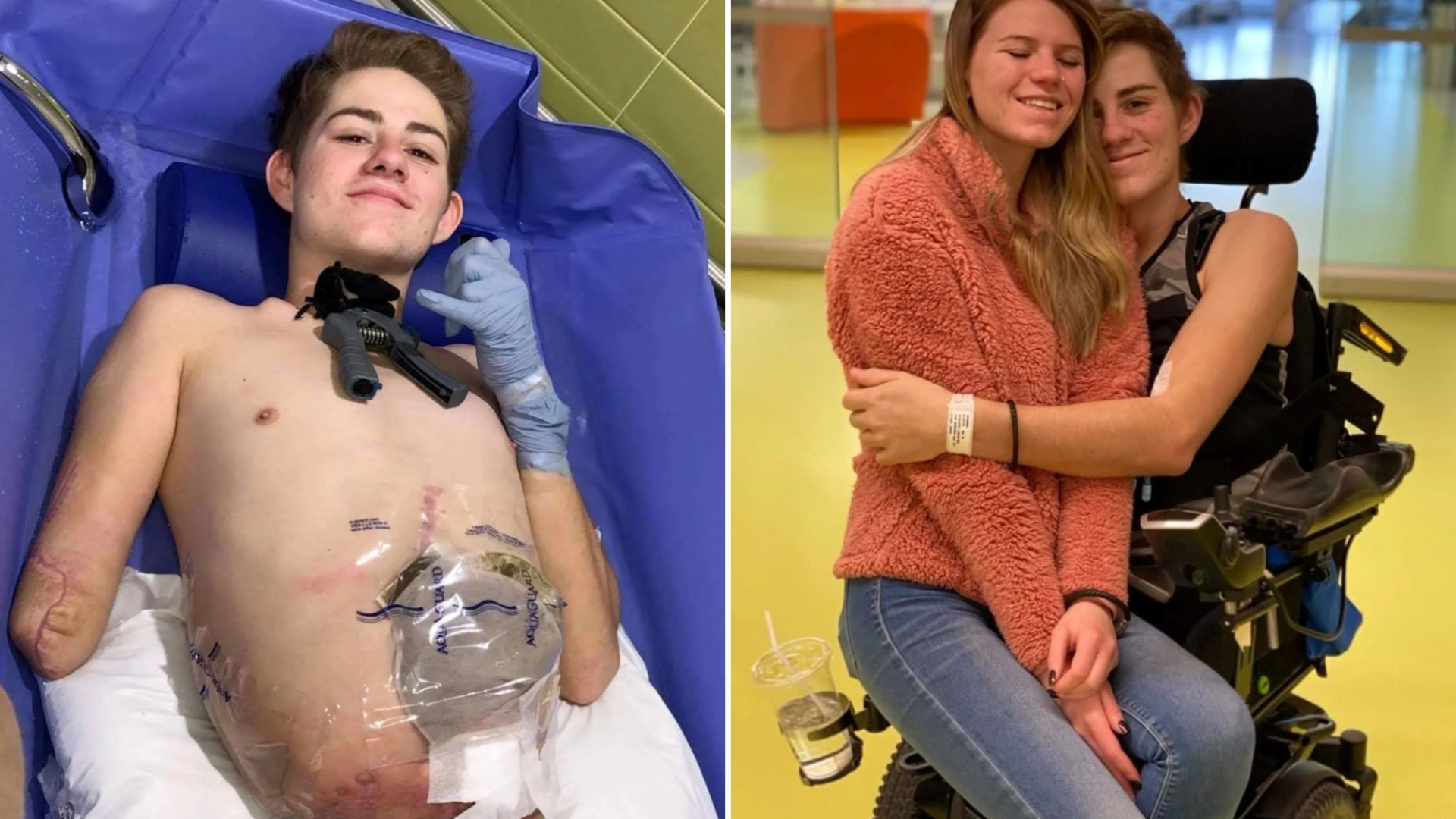 ΗΠΑ: Καταπλακώθηκε από ανυψωτικό και ακρωτηριάστηκε από τη μέση και κάτω – «Μη ρωτάτε πώς κάνω σεξ, είναι αγένεια»