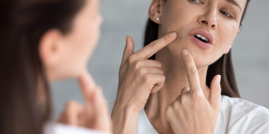 Σπυράκια: Τρείς σπιτικές συνταγές για να τα εξαφανίσεις