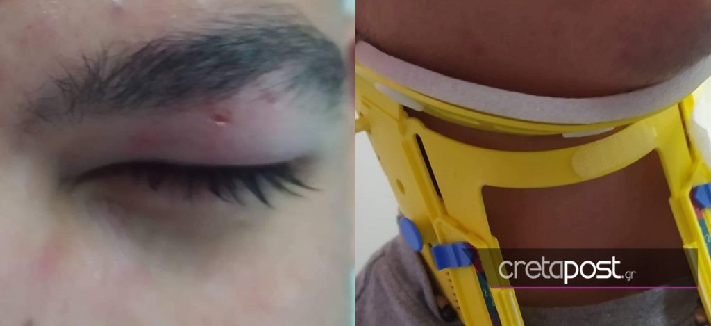 Πρωτοφανές περιστατικό στην Κρήτη: Οδηγός ξυλοκόπησε μαθητή επειδή του έκανε παρατήρηση για τη διάβαση πεζών