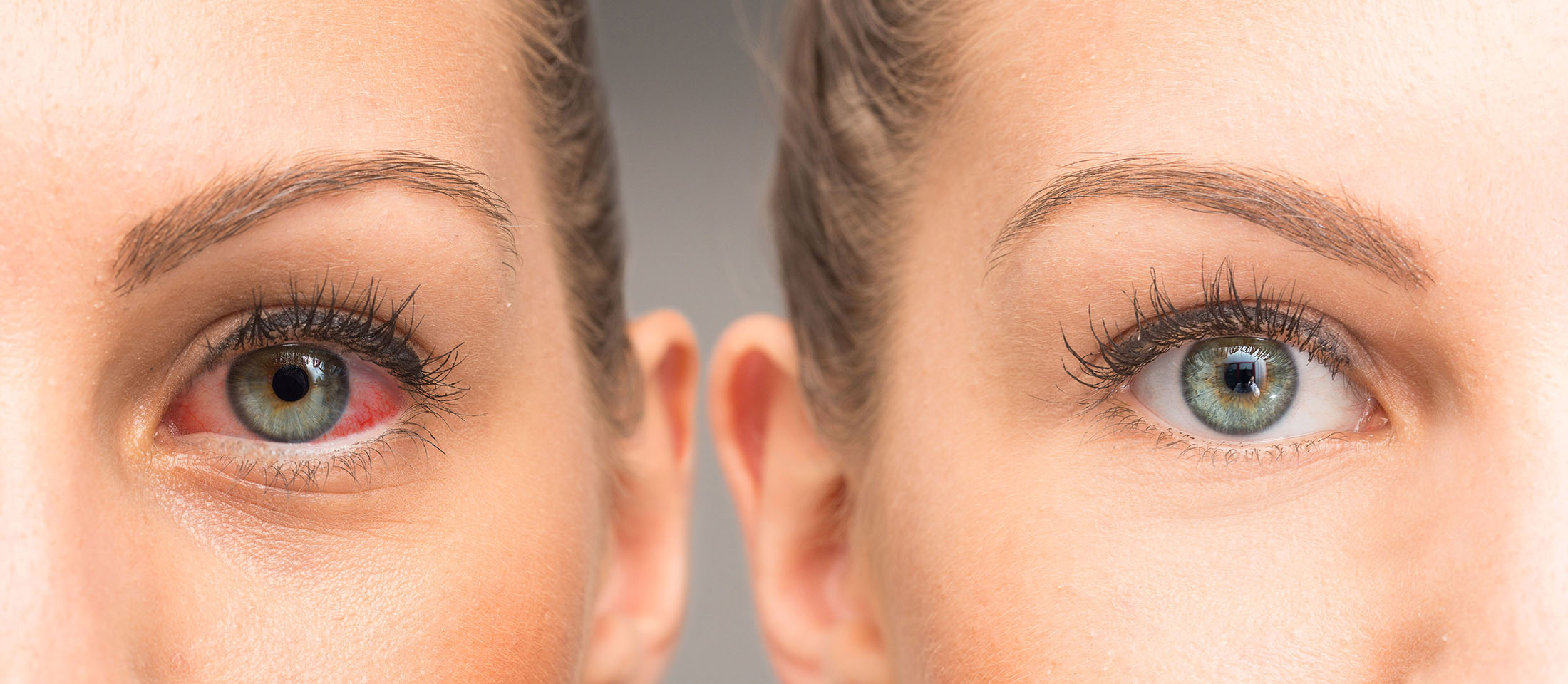 Ο κακός ύπνος συνδέεται με αυξημένο κίνδυνο γλαυκώματος στα μάτια